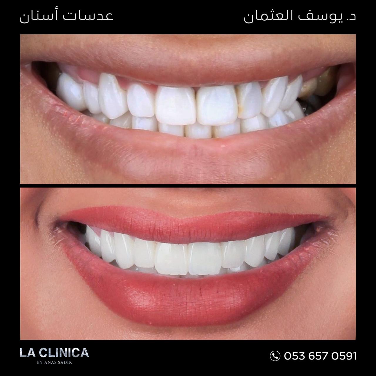 د. يوسف العثمان