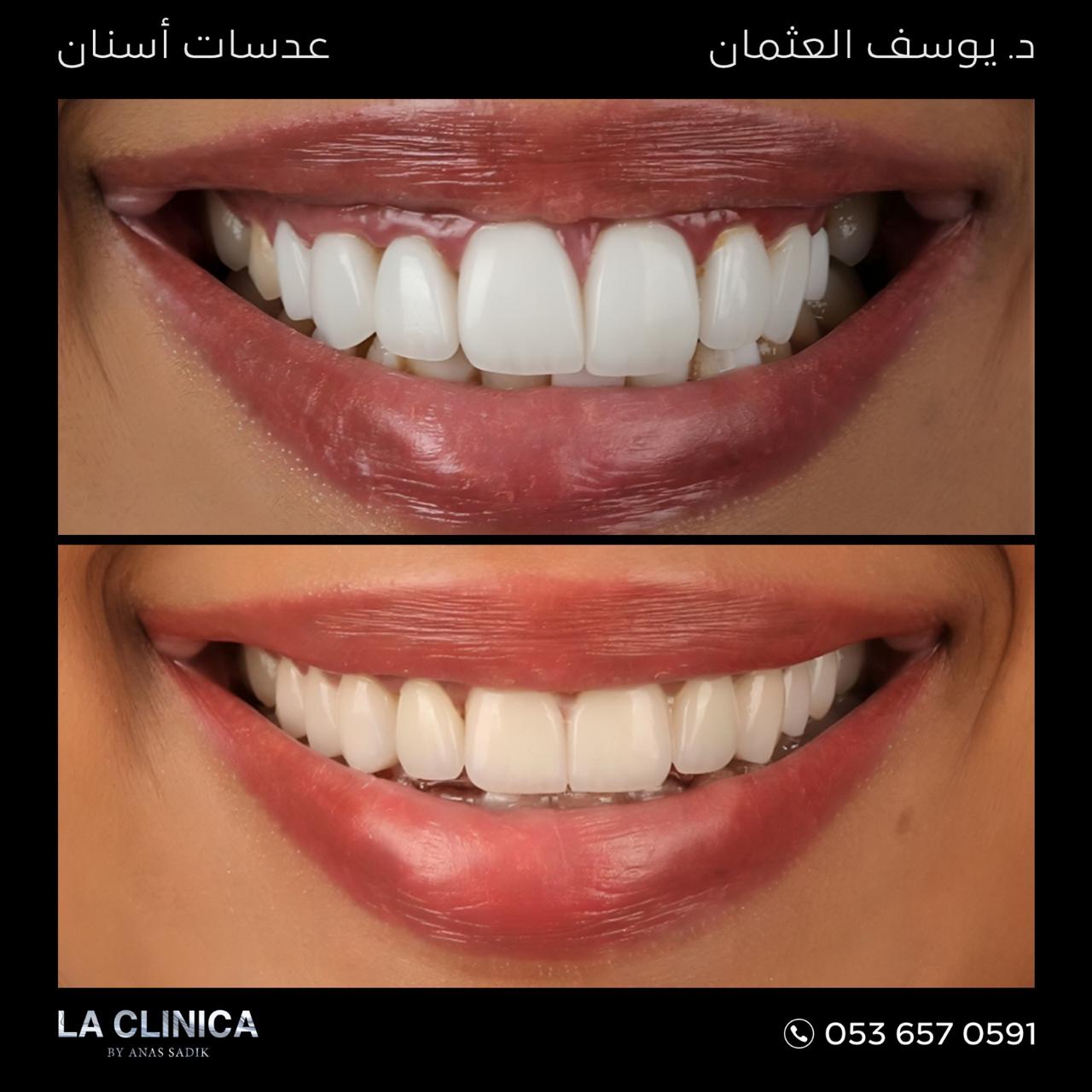 د. يوسف العثمان