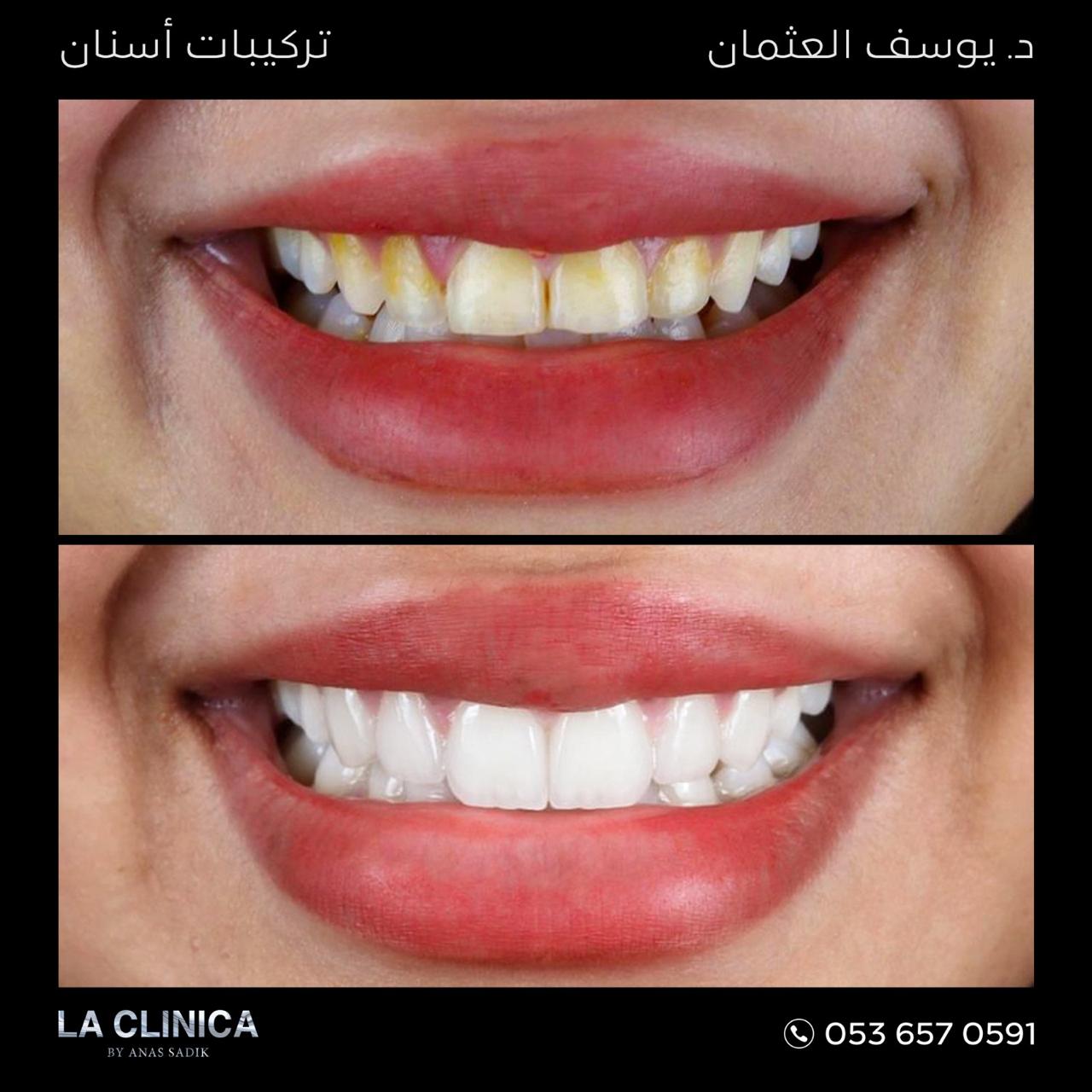 د. يوسف العثمان