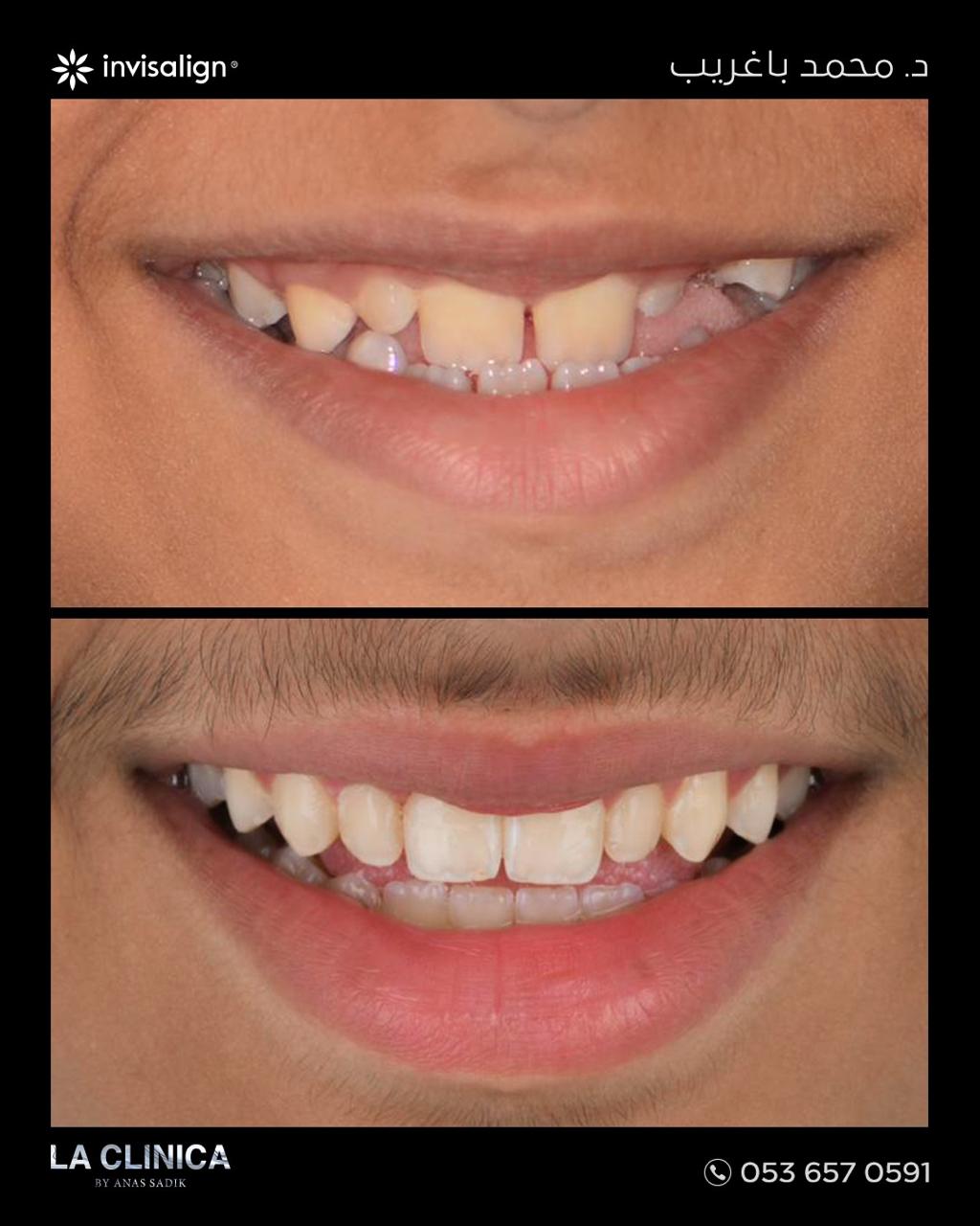 د. محمد باغريب