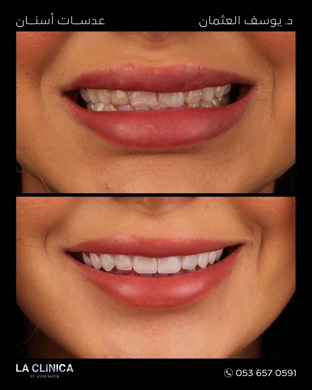 د. يوسف العثمان