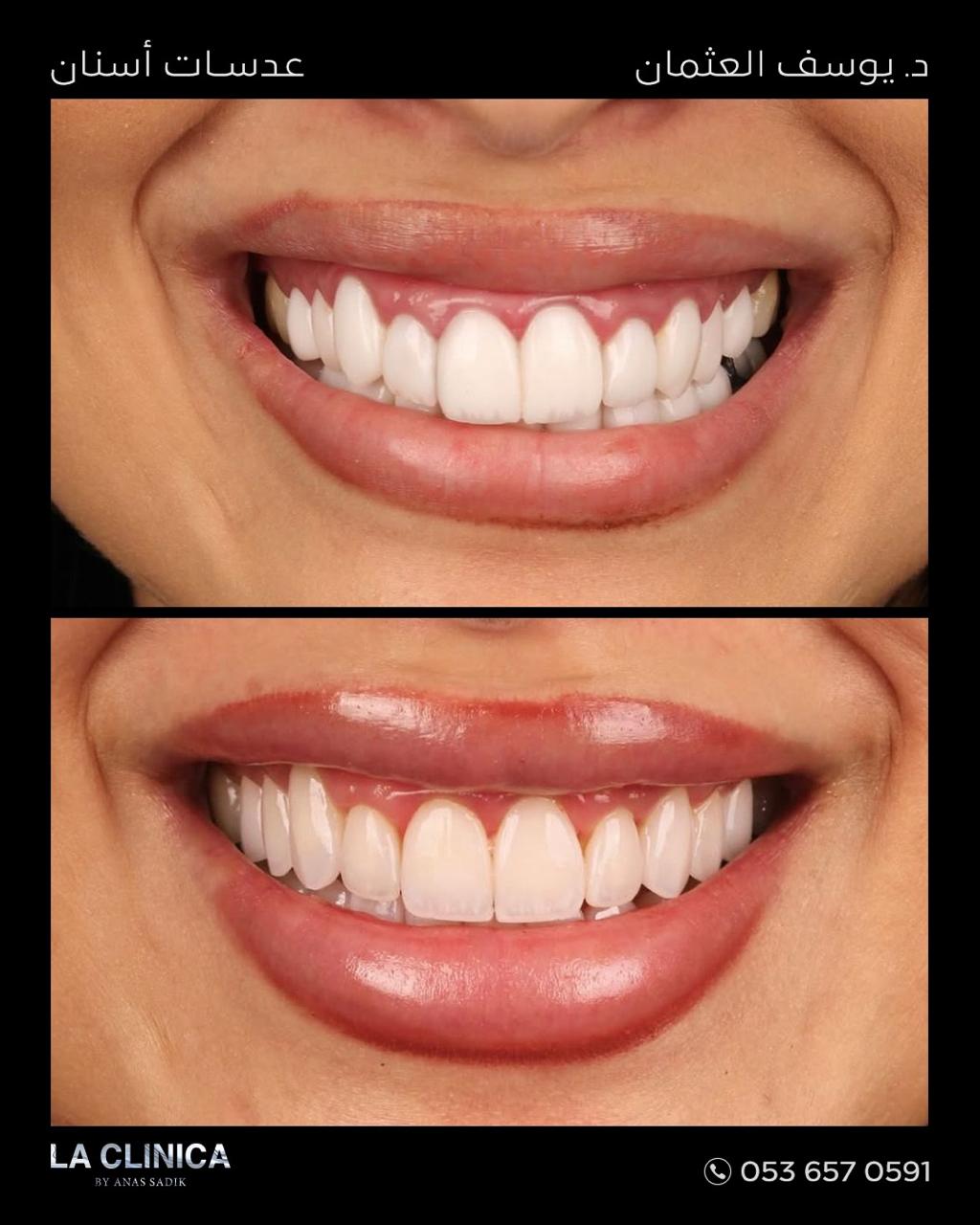 د. يوسف العثمان