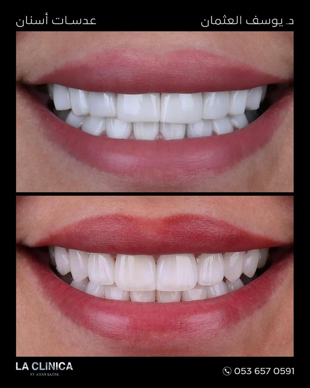 د. يوسف العثمان