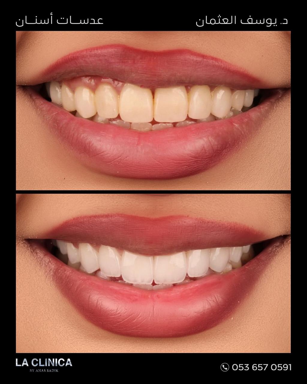 د. يوسف العثمان