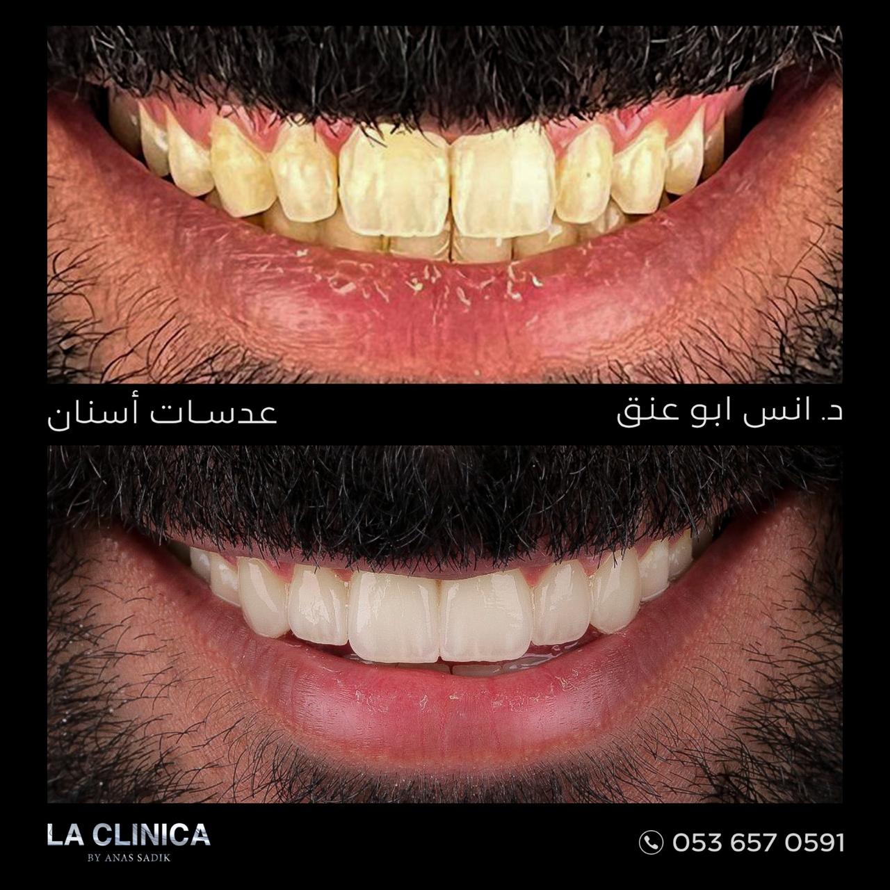 د. انس ابو عنق