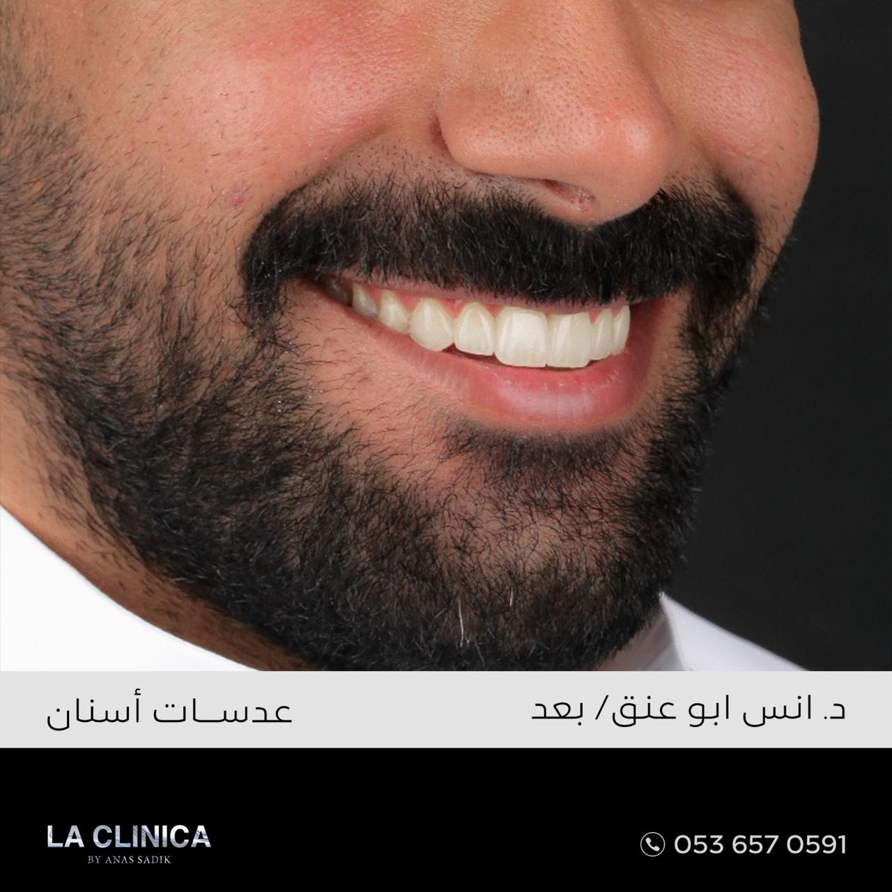 د. انس ابو عنق