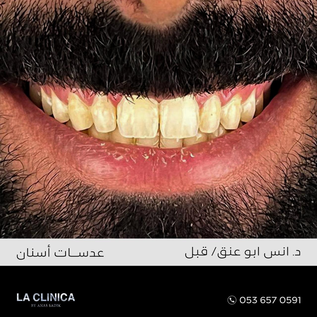 د. انس ابو عنق