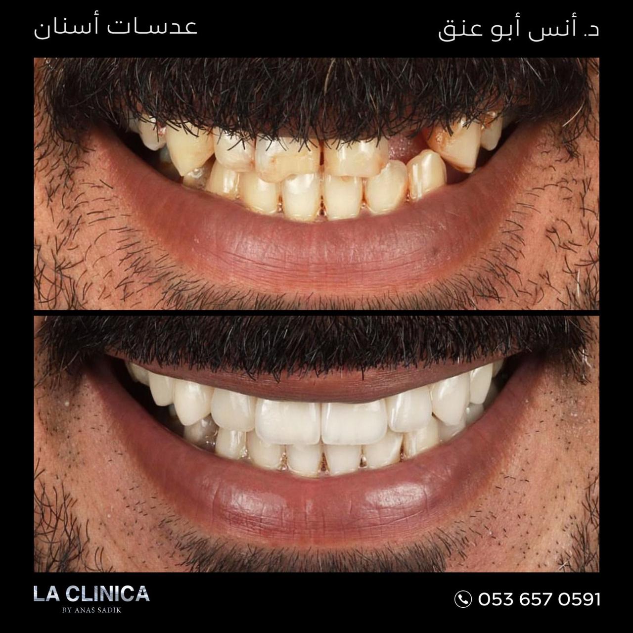 د. انس ابو عنق