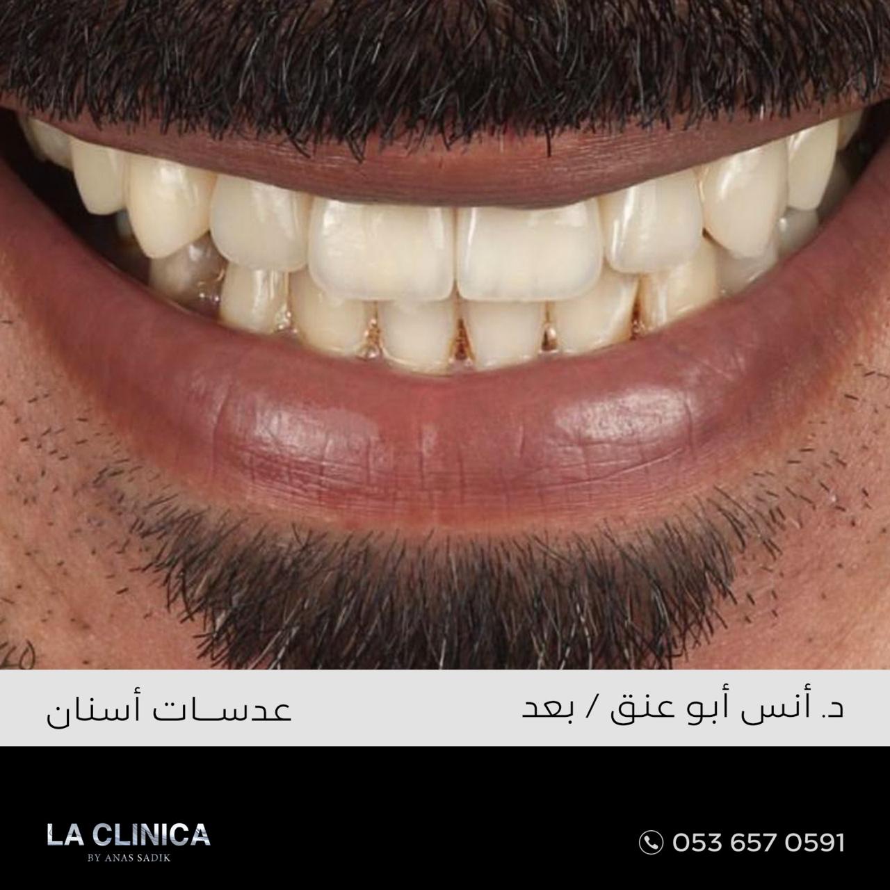 د. انس ابو عنق