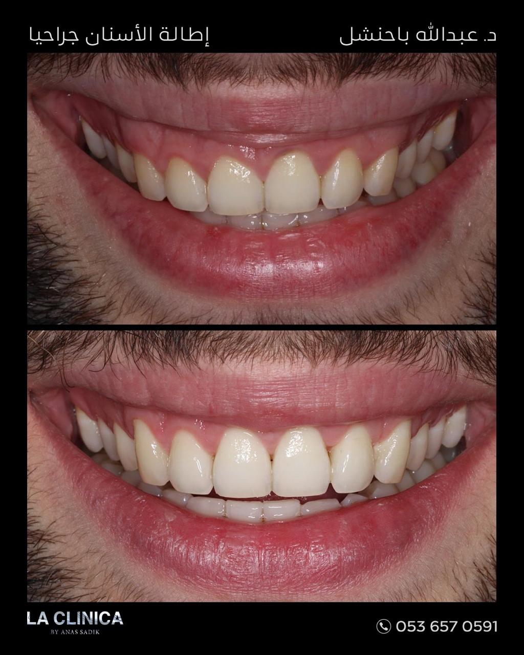 د.عبدالله باحنشل