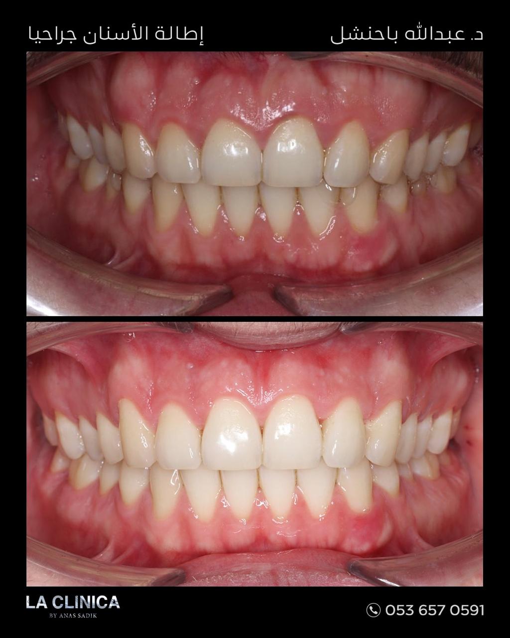 د.عبدالله باحنشل