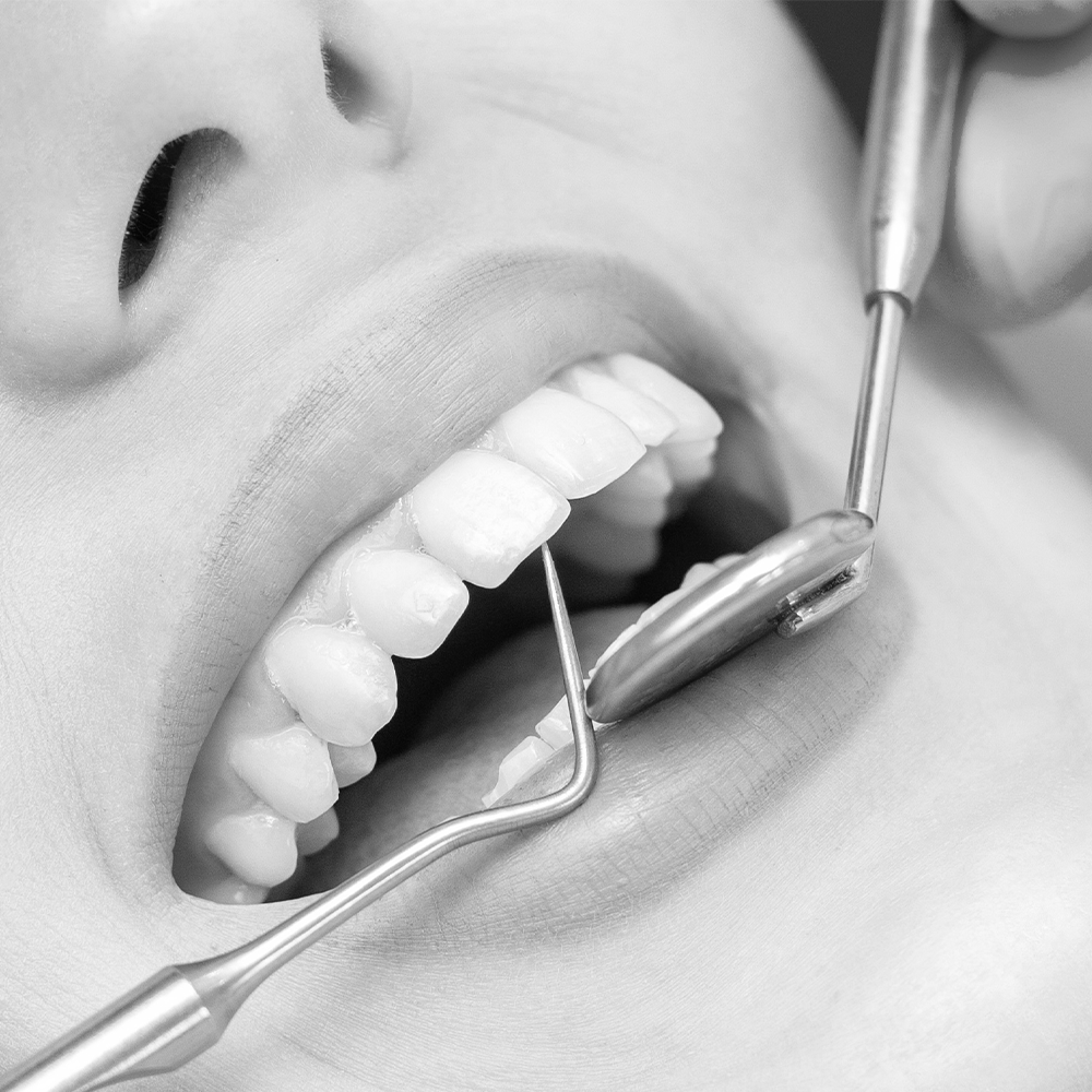 افضل دكتور تركيبات اسنان في السعودية