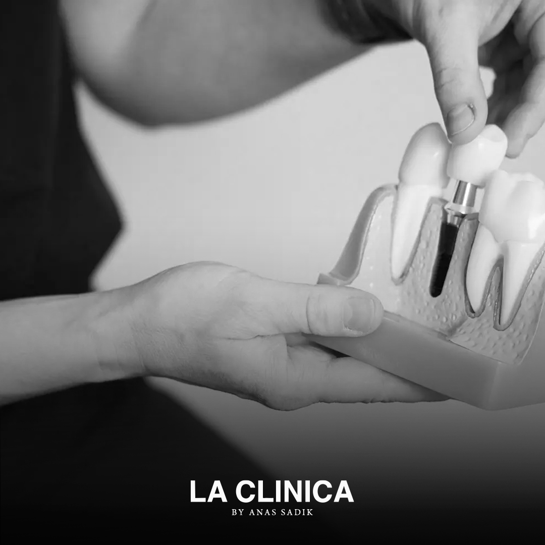 أفضل دكتور تركيبات أسنان تجميلية في الرياض