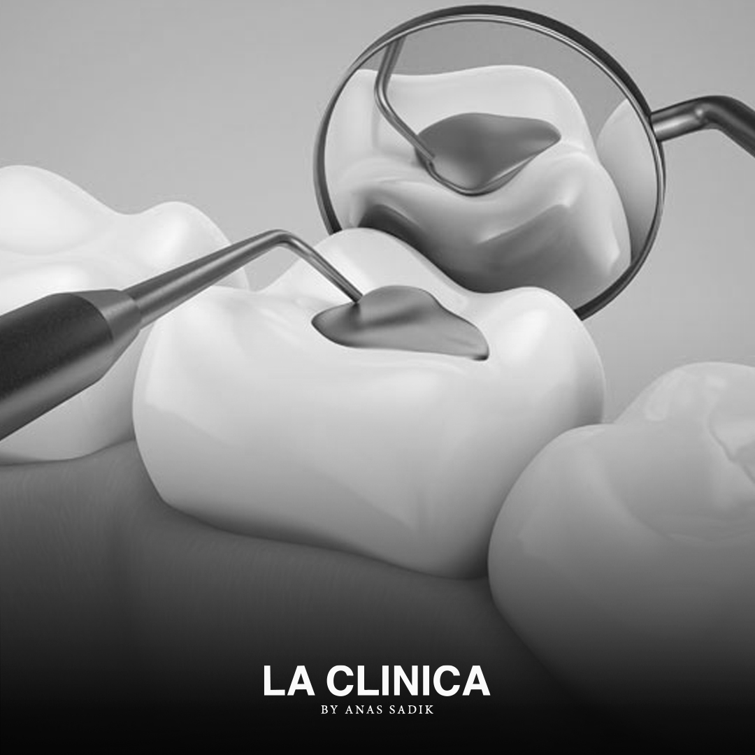 أفضل نوع حشو تجميلي للأسنان الأمامية