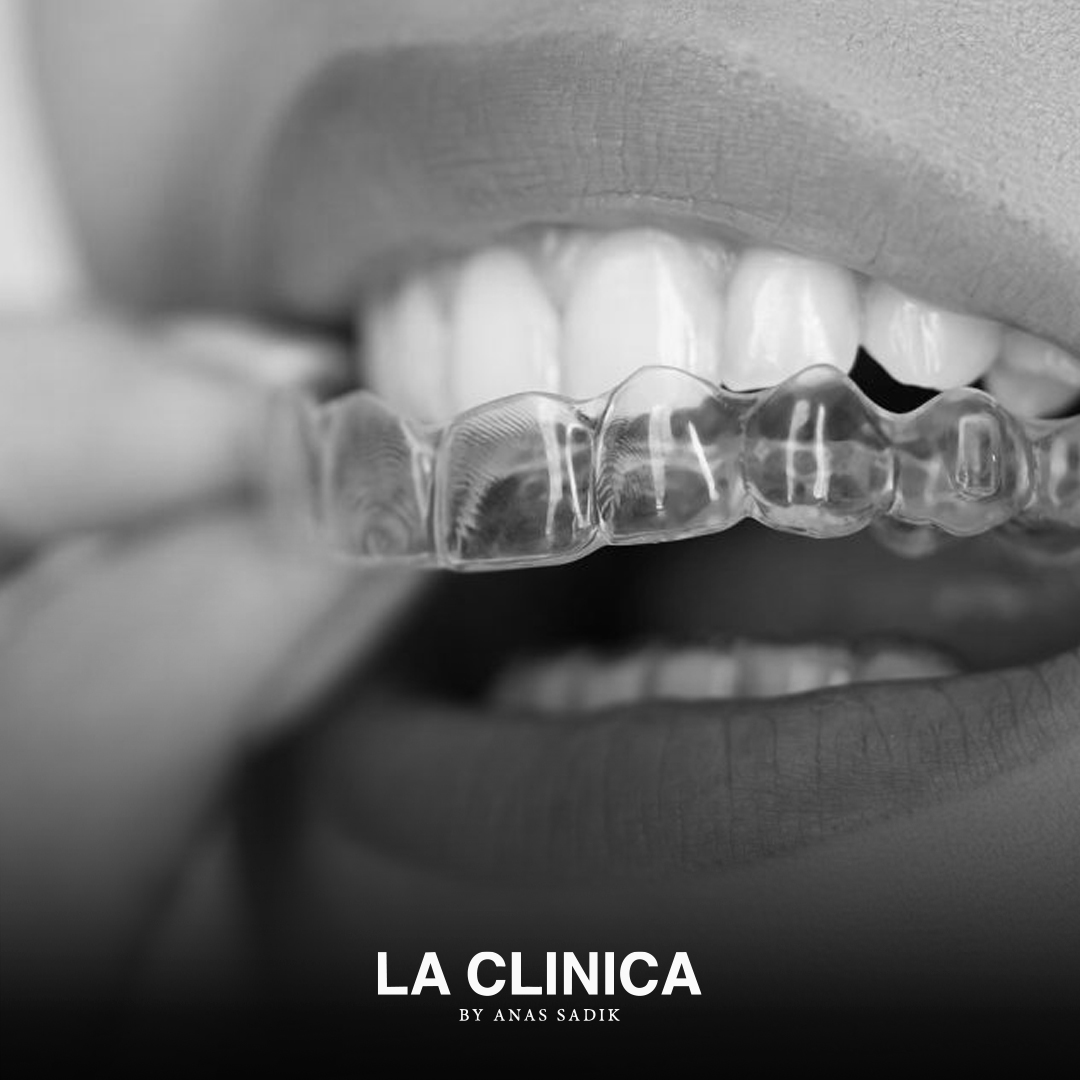 تقويم الأسنان الشفاف إنفزلاين كم مدته؟