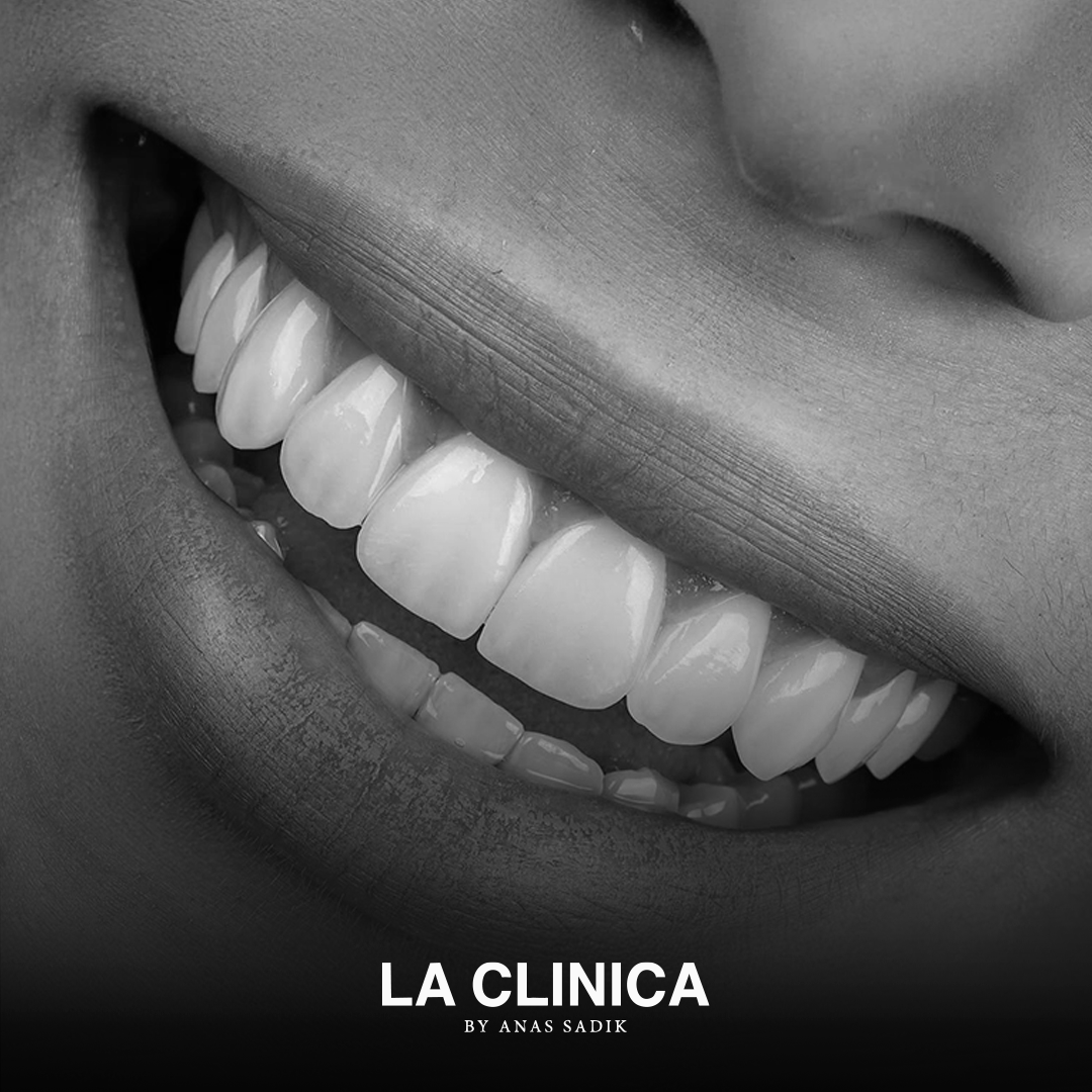 ابتسامة هوليود للمشاهير في الرياض