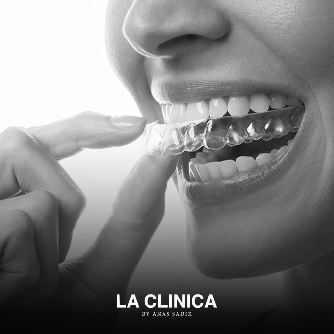 تقويم شفاف إنفزلاين لتصحيح الأسنان الملتوية