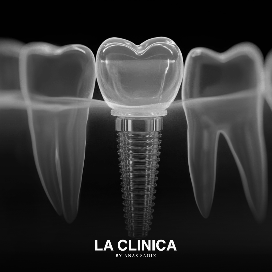 كم تكلفة تركيبات الأسنان الزيركون في الرياض