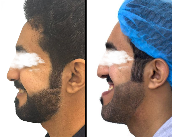 Maxillofacial Surgery