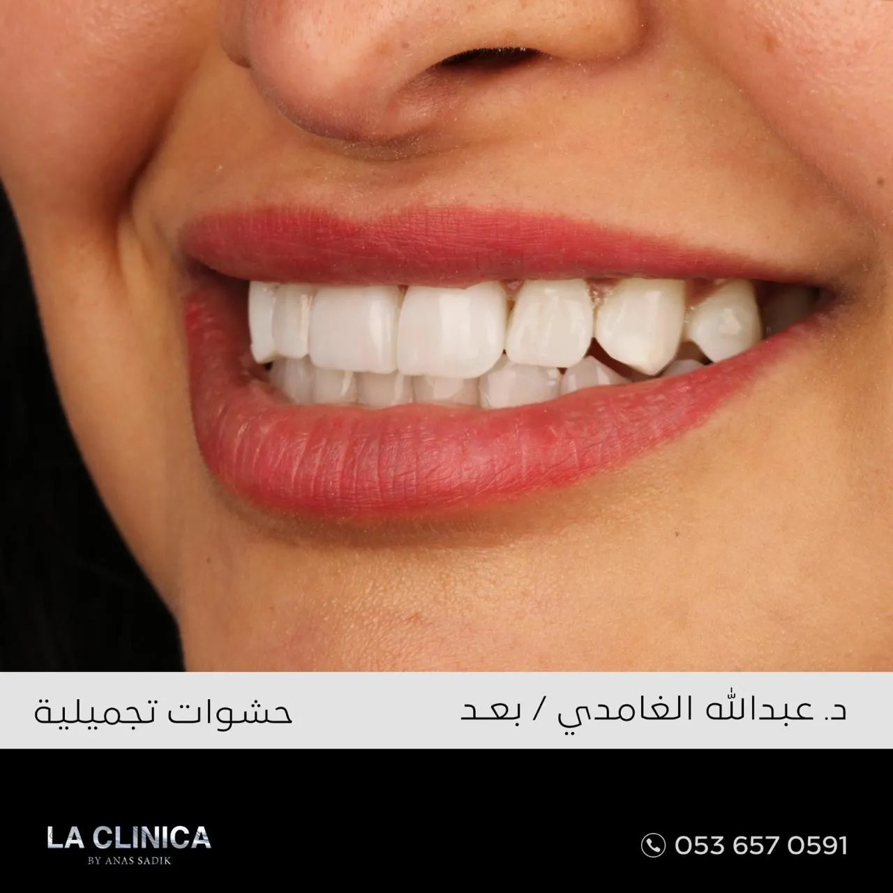 بعد