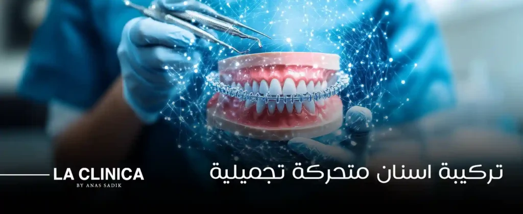 تركيبة اسنان متحركة تجميلية