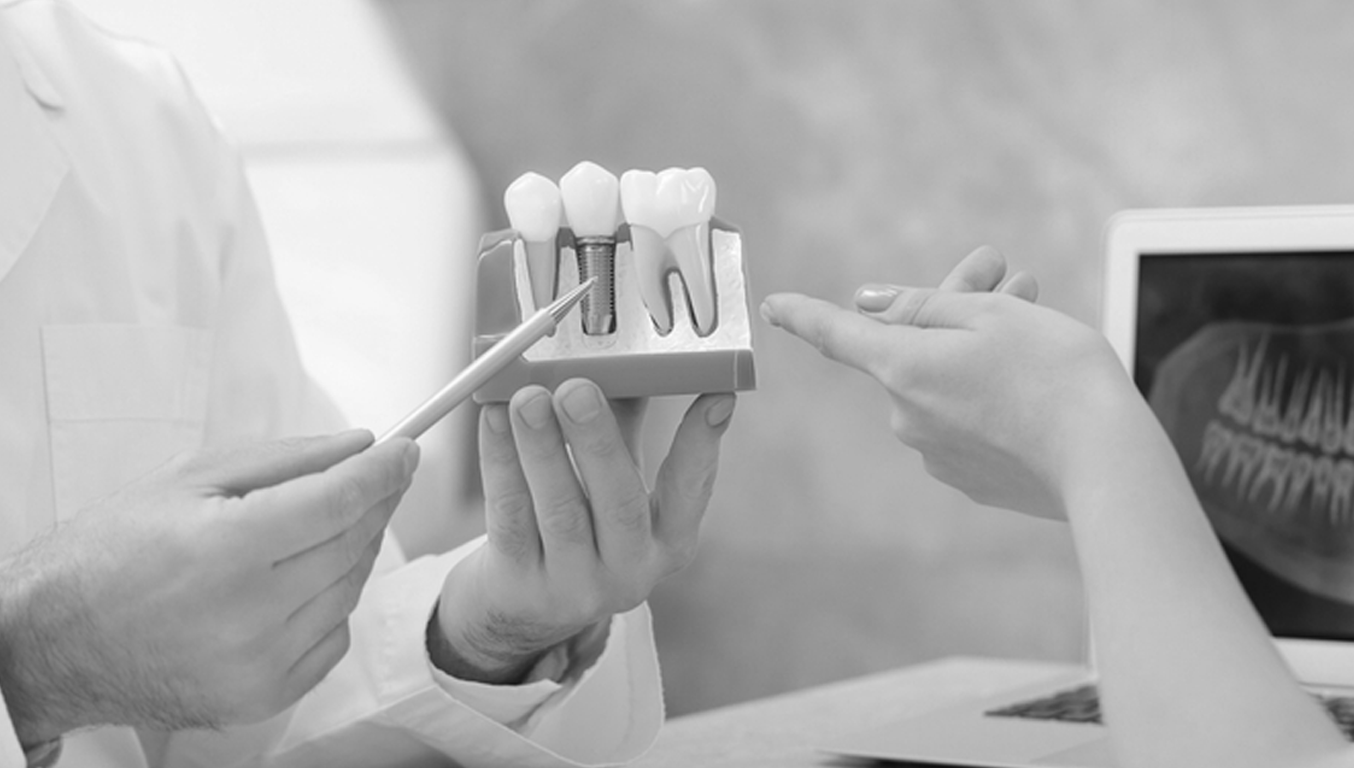 من هو أفضل دكتور تركيبات اسنان شاطر في الرياض؟