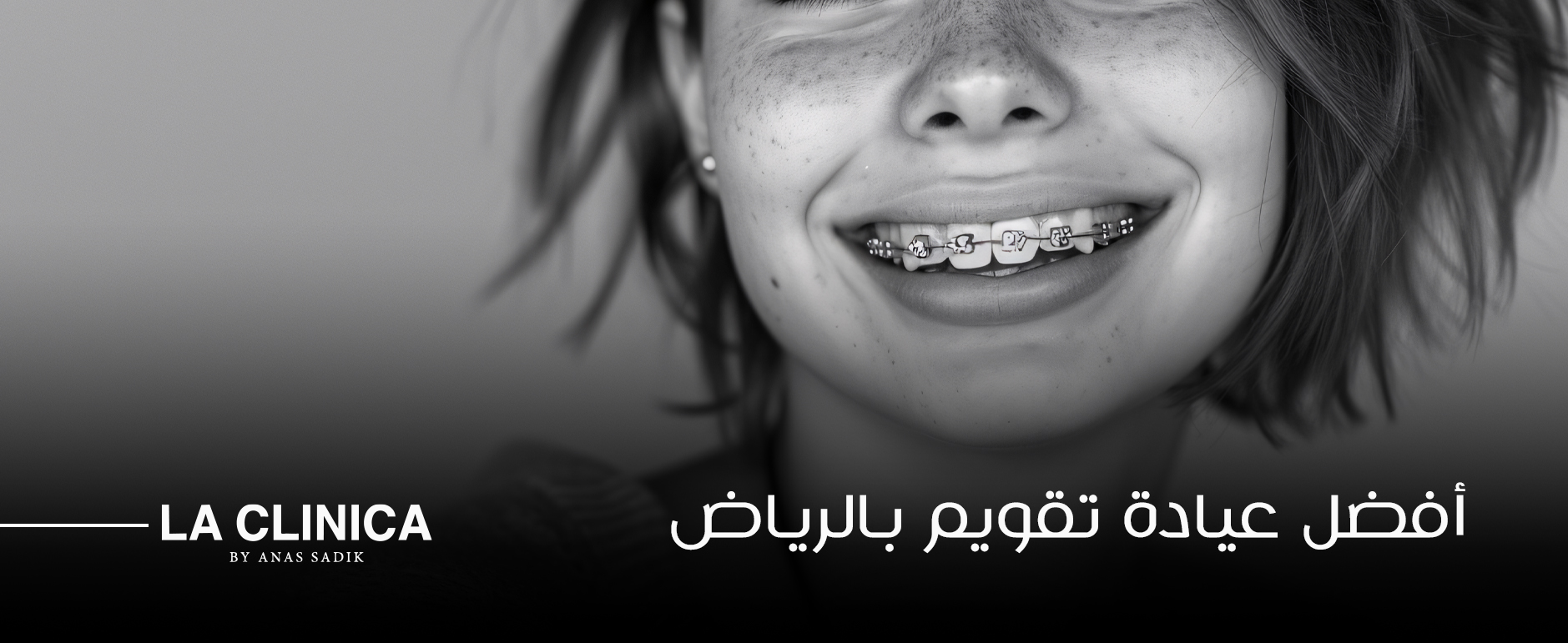 أفضل عيادة تقويم بالرياض و المعايير التي تحدد أفضل عيادة تقويم بالرياض