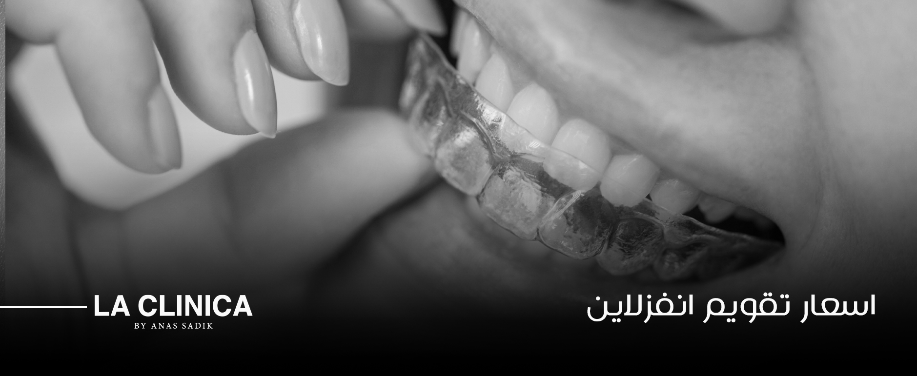 كل ما تحتاج معرفته عن اسعار تقويم انفزلاين في عيادات لاكلينيكا
