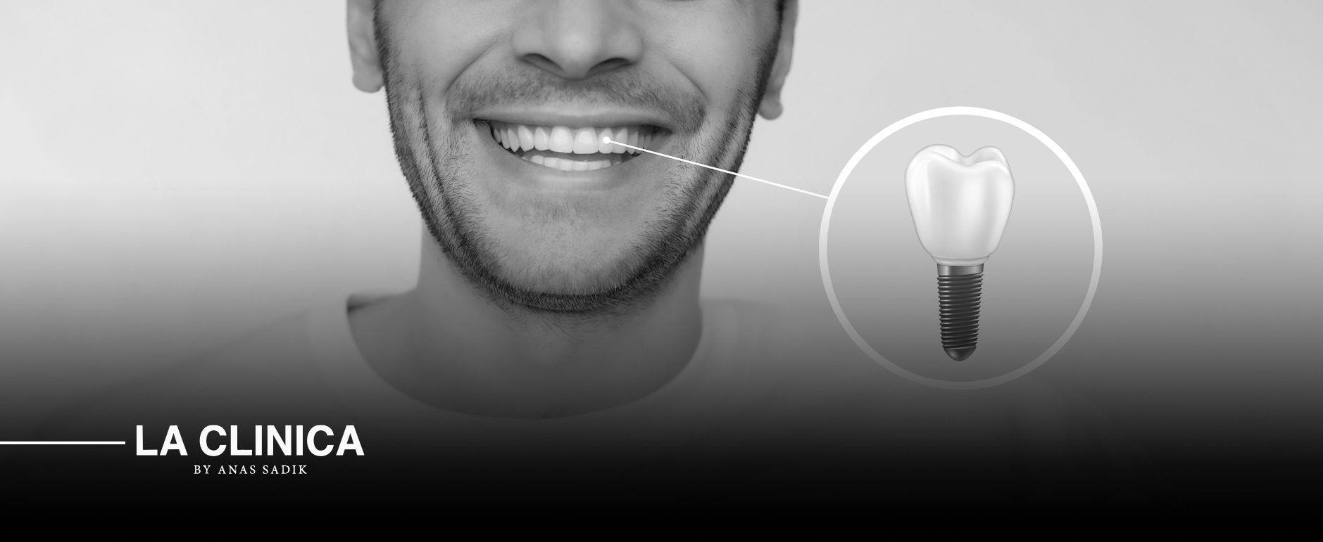 افضل دكتور زراعة اسنان شمال الرياض