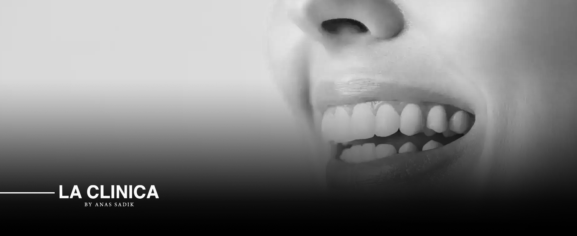 لاكلينيكا افضل عيادة ابتسامة هوليود بالرياض