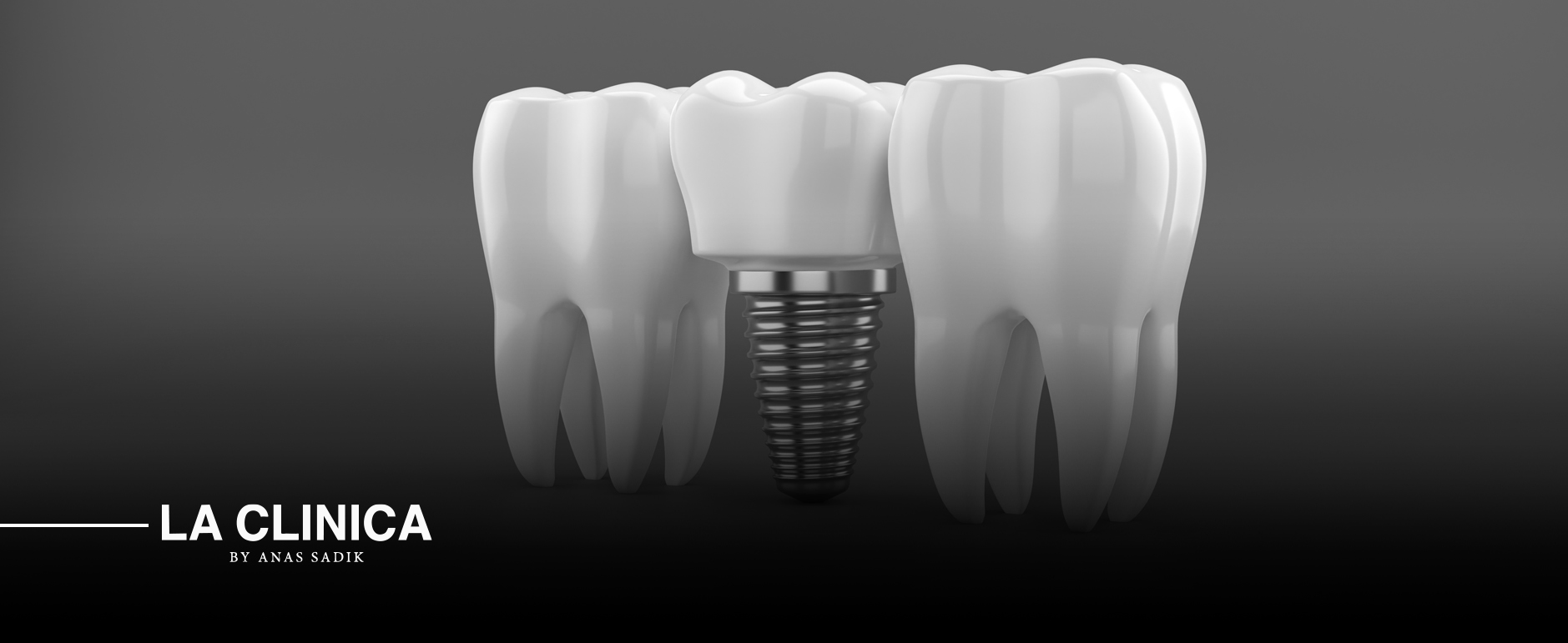 أنواع زراعة الأسنان وافضلها