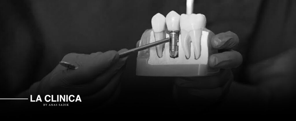 أفضل دكتور تركيبات أسنان تجميلية في الرياض