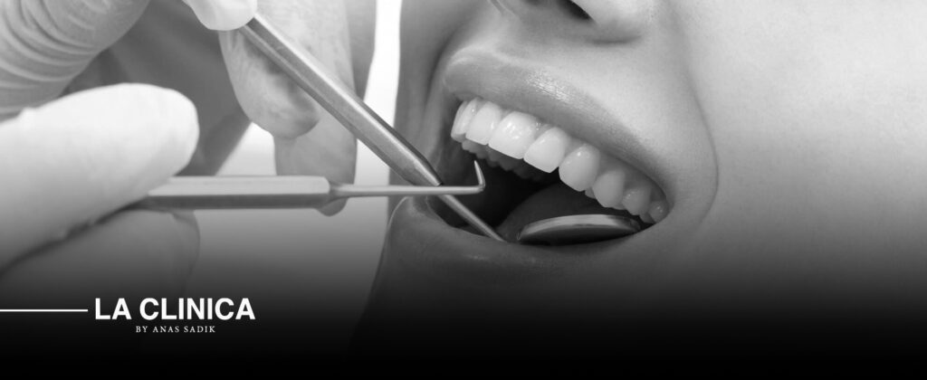 أفضل نوع حشو تجميلي للأسنان الأمامية