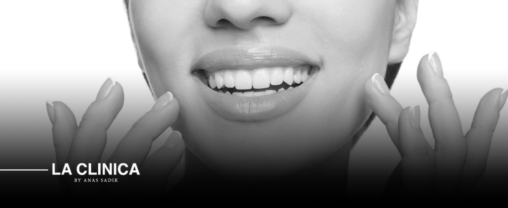 ابتسامة هوليود للمشاهير في الرياض