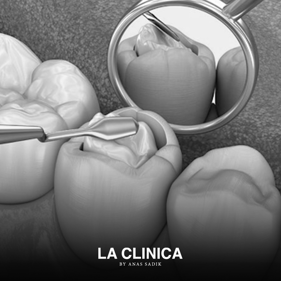 الفرق بين الحشو التجميلي والحشو العادي