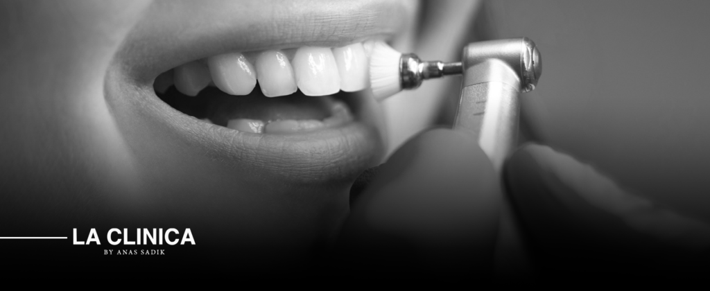 تنظيف الأسنان العميق