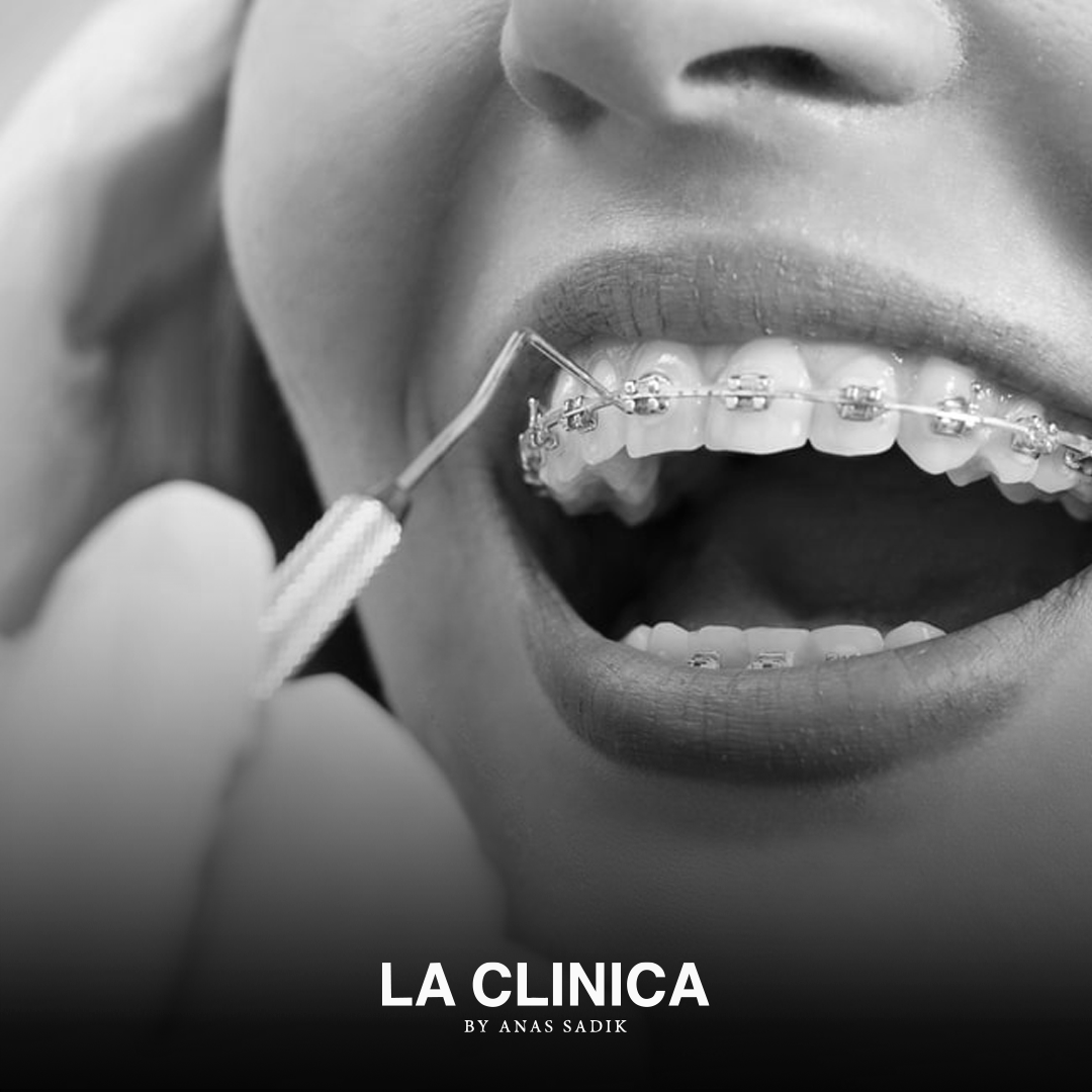 Best orthodontist in Riyadh