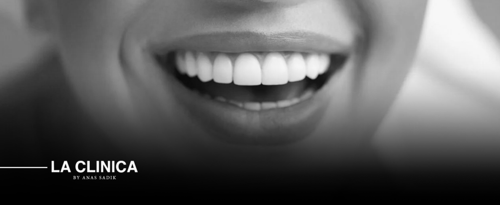 Cosmetic dentistry in Riyadh
