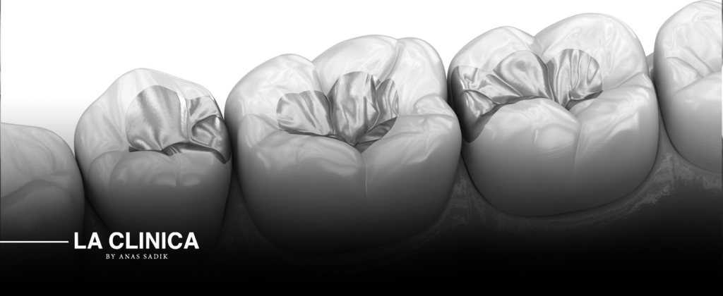 Dental Fillings in Riyadh