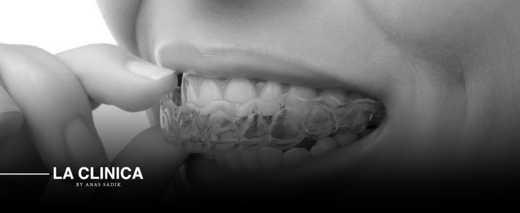 Invisalign in Riyadh