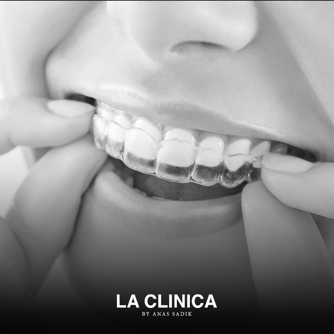 Invisalign in Riyadh