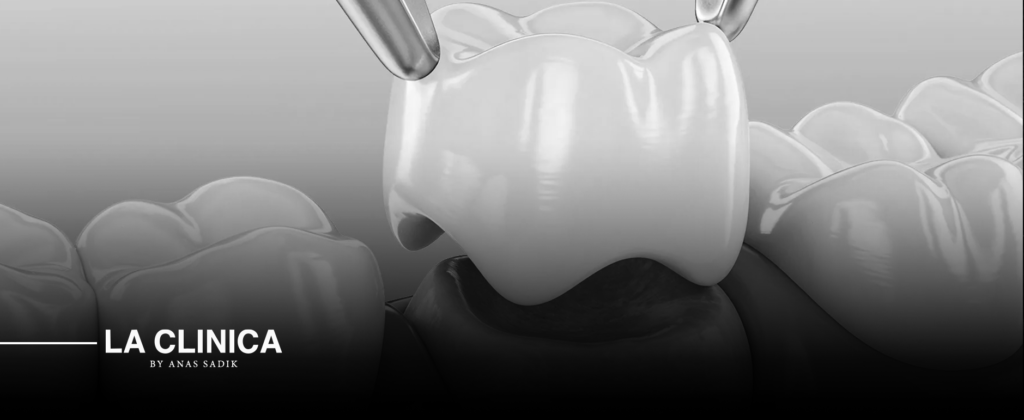 أفضل دكتور تركيبات زيركون في الرياض