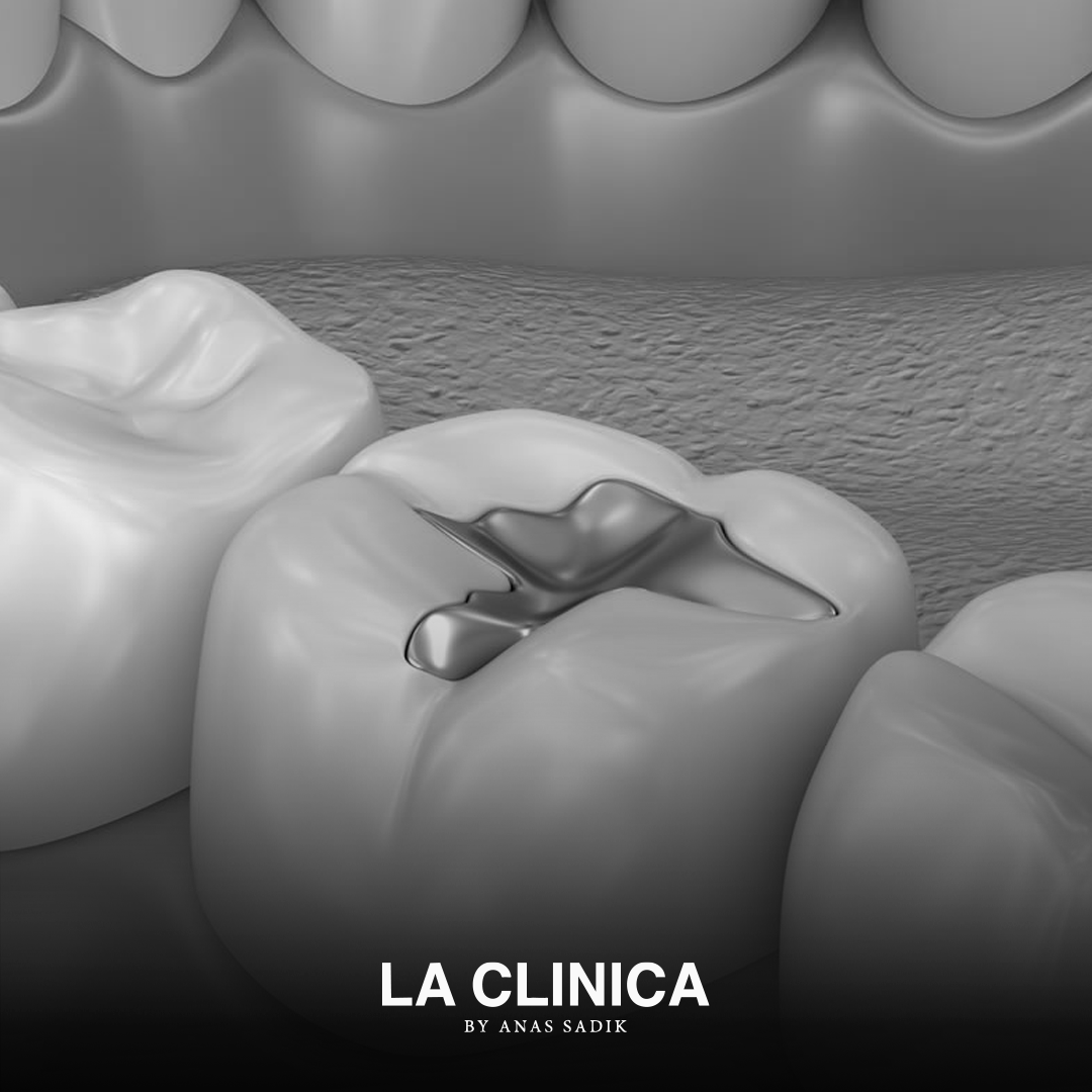أفضل دكتور حشوات تجميلية في الرياض