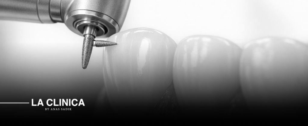 إعادة تشكيل الأسنان