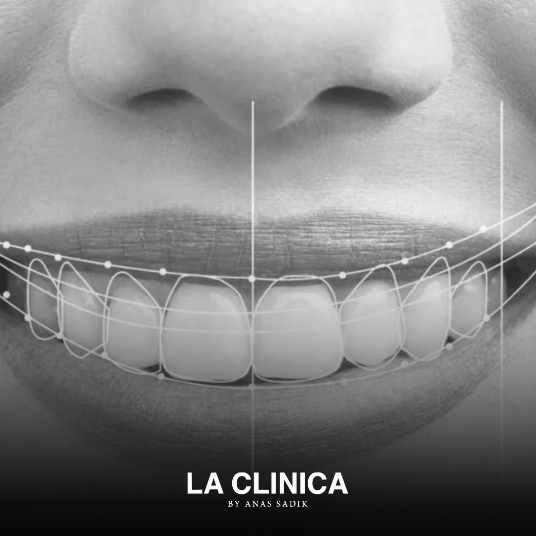 إعادة تشكيل الأسنان