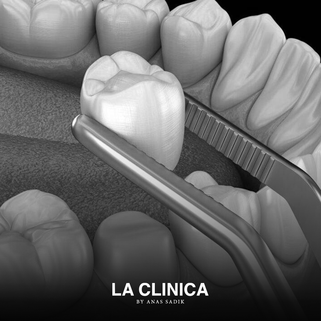 تركيب تاج الأسنان