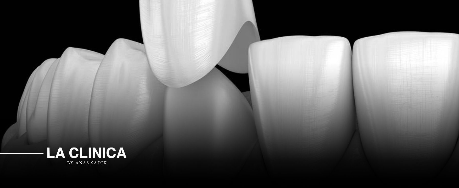 تركيب تاج الأسنان