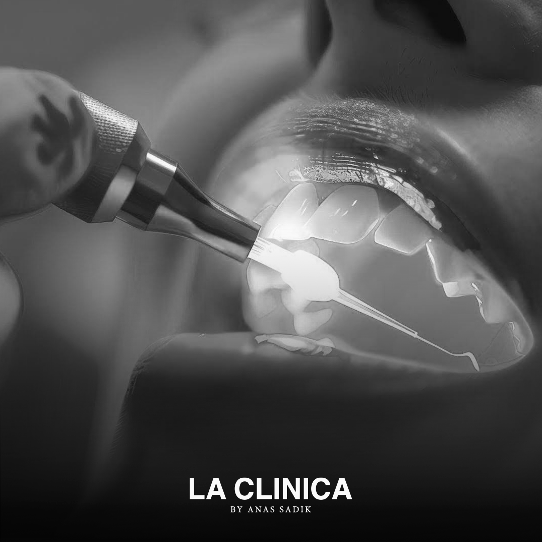 علاج الأسنان بالليزر