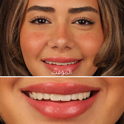الابتسامة التجريبية