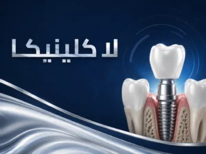 أفضل مركز زراعة الأسنان في السعودية
